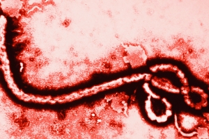 S-a descoperit proteina care oferă protecţie împotriva virusului Ebola